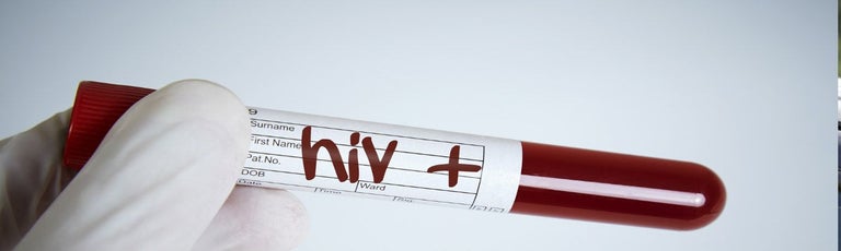 HIV positive stick